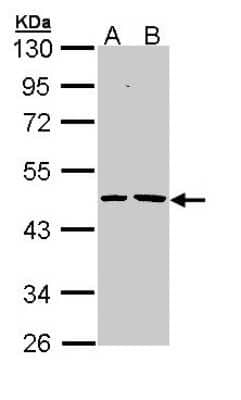 Western Blot: EPHX1 Antibody [NBP1-32882]