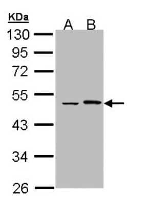 Western Blot: EPHX1 Antibody [NBP1-33011]