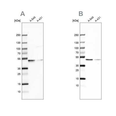 Western Blot: EPHX1 Antibody [NBP1-83969]