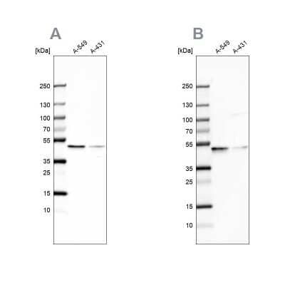 Western Blot: EPHX1 Antibody [NBP2-38594]