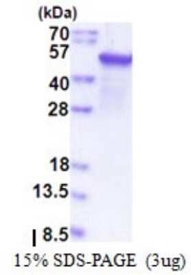 SDS-PAGE: Recombinant Human EPHX1 T7 Protein [NBP2-51575]