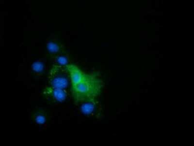 Immunocytochemistry/ Immunofluorescence: EPHX2 Antibody (OTI1A6) [NBP2-02948]