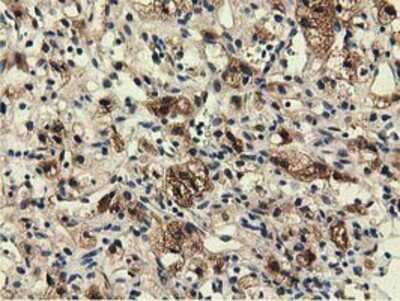 Immunohistochemistry-Paraffin: EPHX2 Antibody (OTI1A6) [NBP2-02948]