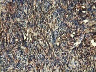 Immunohistochemistry-Paraffin: EPHX2 Antibody (OTI1A6) [NBP2-02948]