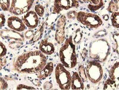 Immunohistochemistry-Paraffin: EPHX2 Antibody (OTI1A6) [NBP2-02948]