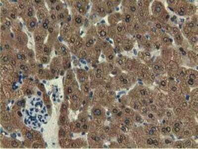 Immunohistochemistry-Paraffin: EPHX2 Antibody (OTI1A6) [NBP2-02948]