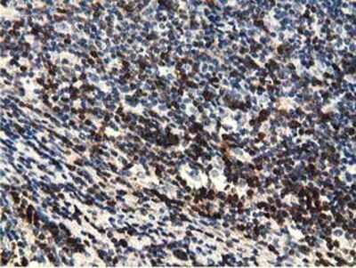 Immunohistochemistry-Paraffin: EPHX2 Antibody (OTI1A6) [NBP2-02948]