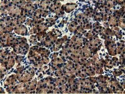Immunohistochemistry-Paraffin: EPHX2 Antibody (OTI1A6) [NBP2-02948]