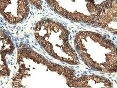 Immunohistochemistry-Paraffin: EPHX2 Antibody (OTI1A6) [NBP2-02948]