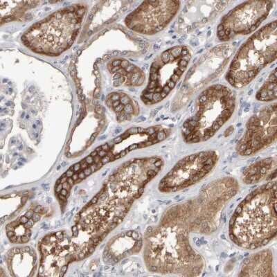 Immunohistochemistry-Paraffin: EPHX2 Antibody [NBP1-89534]
