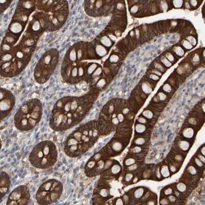 Immunohistochemistry-Paraffin: EPHX2 Antibody [NBP1-89534]