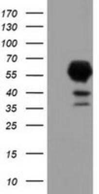 Western Blot: EPHX2 Antibody (OTI1A6)Azide and BSA Free [NBP2-70648]