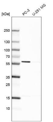 Western Blot: EPHX2 Antibody [NBP1-89534]