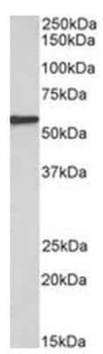 Western Blot: EPHX2 Antibody [NBP2-44321]