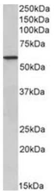 Western Blot: EPHX2 Antibody [NBP2-44322]