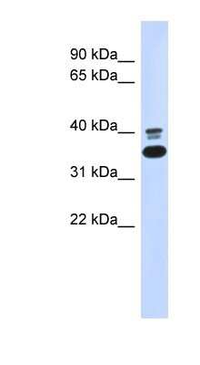 Western Blot: EPHX4 Antibody [NBP1-62668]