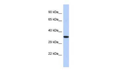 Western Blot: EPHX4 Antibody [NBP2-84860]