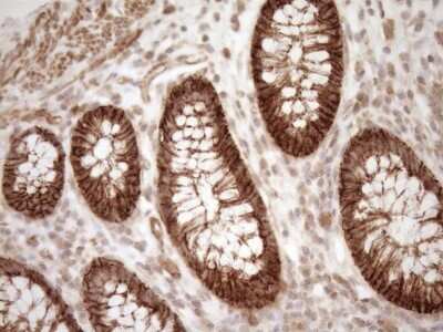 Immunohistochemistry: EPLIN Antibody (OTI1A3) [NBP2-45652]