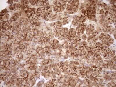 Immunohistochemistry: EPLIN Antibody (OTI1A3) [NBP2-45652]