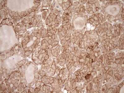 Immunohistochemistry: EPLIN Antibody (OTI1A3) [NBP2-45652]