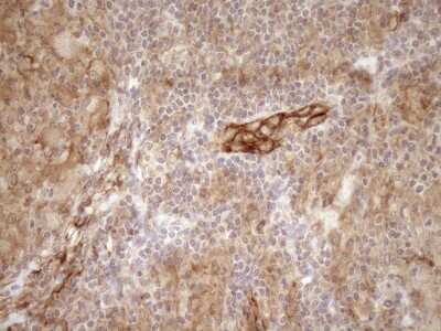 Immunohistochemistry: EPLIN Antibody (OTI1A3) [NBP2-45652]