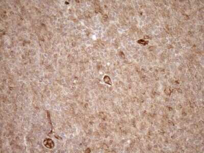 Immunohistochemistry: EPLIN Antibody (OTI1A3) [NBP2-45652]