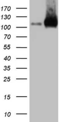 Western Blot: EPLIN Antibody (OTI1A3) [NBP2-45652]