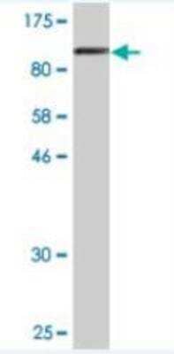 Western Blot: EPLIN Antibody (1B7) [H00051474-M06]