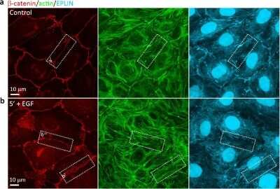 Immunocytochemistry/ Immunofluorescence: EPLIN Antibody [NB100-2305]