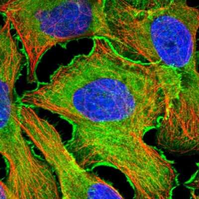 Immunocytochemistry/ Immunofluorescence: EPLIN Antibody [NBP1-87947]