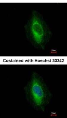 Immunocytochemistry/ Immunofluorescence: EPLIN Antibody [NBP2-16354]