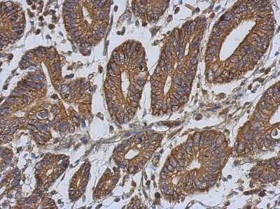 Immunohistochemistry-Paraffin: EPLIN Antibody [NBP2-16355]