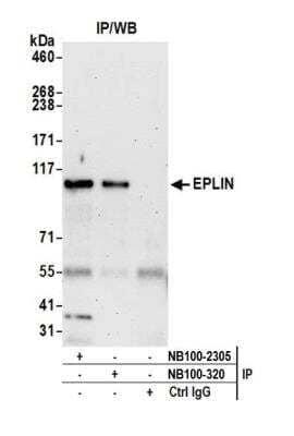 Immunoprecipitation: EPLIN Antibody [NB100-2305]