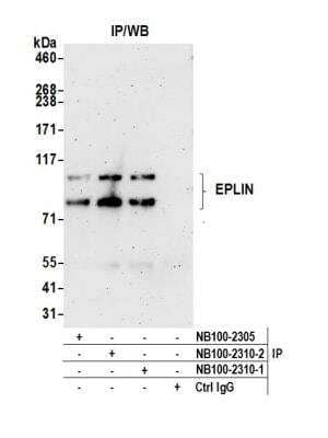 Immunoprecipitation: EPLIN Antibody [NB100-2310]