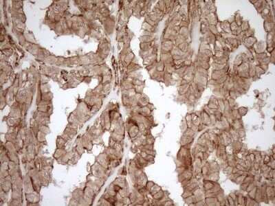 Immunohistochemistry: EPLIN Antibody (OTI1A3) - Azide and BSA Free [NBP2-71932]