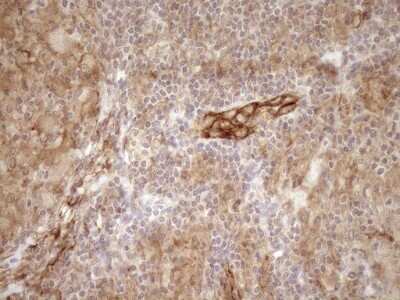 Immunohistochemistry: EPLIN Antibody (OTI1A3) - Azide and BSA Free [NBP2-71932]