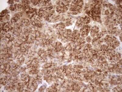 Immunohistochemistry: EPLIN Antibody (OTI1A3) - Azide and BSA Free [NBP2-71932]