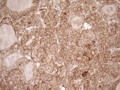 Immunohistochemistry: EPLIN Antibody (OTI1A3) - Azide and BSA Free [NBP2-71932]