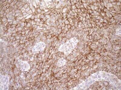 Immunohistochemistry: EPLIN Antibody (OTI1A3) - Azide and BSA Free [NBP2-71932]