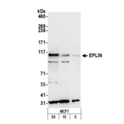 Western Blot: EPLIN Antibody [NB100-2305]