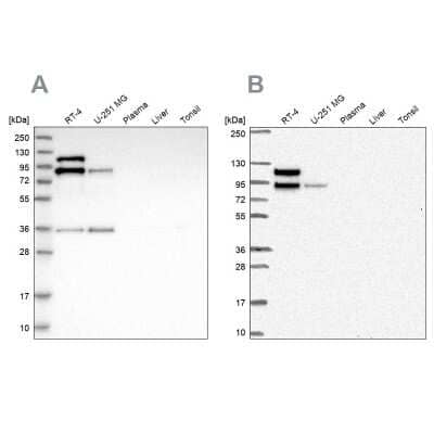 Western Blot: EPLIN Antibody [NBP1-87947]