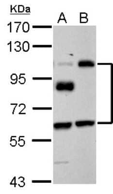 Western Blot: EPLIN Antibody [NBP2-16354]