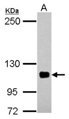 Western Blot: EPLIN Antibody [NBP2-16355]