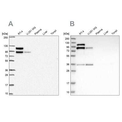 Western Blot: EPLIN Antibody [NBP2-38673]