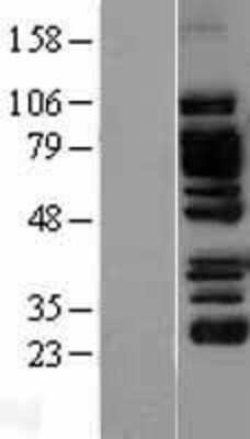 Western Blot: EPLIN Overexpression Lysate [NBL1-12533]