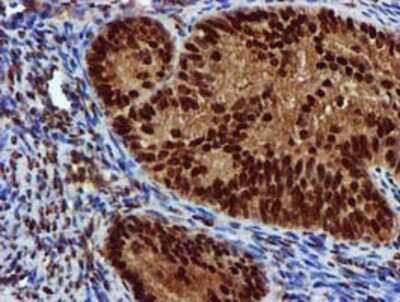 Immunohistochemistry-Paraffin: EPM2AIP1 Antibody (OTI2A2) [NBP2-03092]