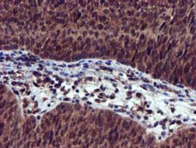 Immunohistochemistry-Paraffin: EPM2AIP1 Antibody (OTI2A2) [NBP2-03092]
