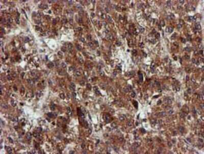 Immunohistochemistry-Paraffin: EPM2AIP1 Antibody (OTI2A2) [NBP2-03092]