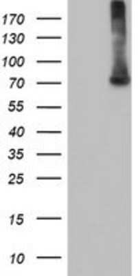 Western Blot: EPM2AIP1 Antibody (OTI2A2) [NBP2-03092]