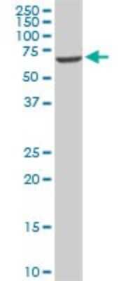 Western Blot: EPM2AIP1 Antibody (3H7) [H00009852-M01]